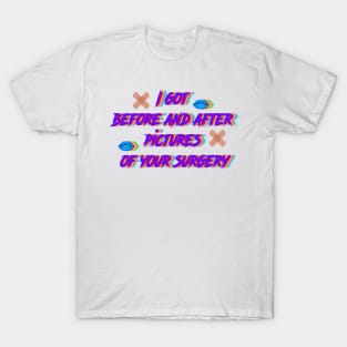 I got  before and after  pictures  of your surgery T-Shirt
